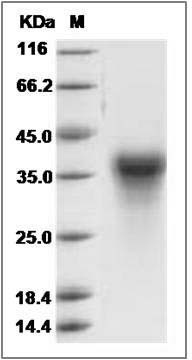 Rat CLEC5A / MDL1 / MDL-1 Protein (His Tag) SDS-PAGE