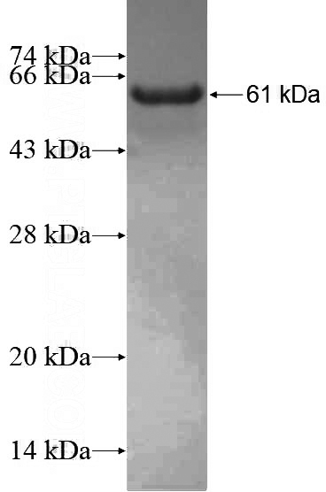 Recombinant Human HSD17B4 SDS-PAGE