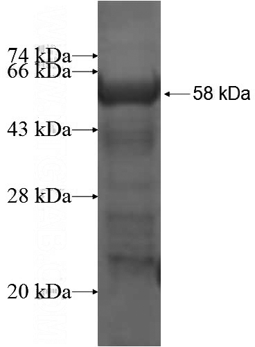 Recombinant Human PITPNB SDS-PAGE