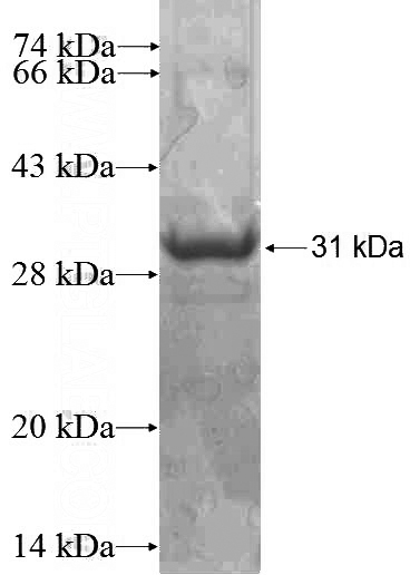 Recombinant Human DGKZ SDS-PAGE