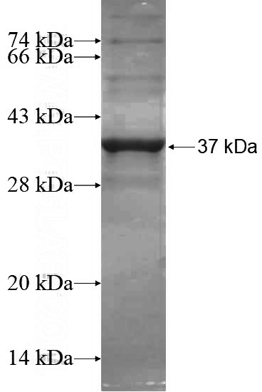 Recombinant Human ITGAV SDS-PAGE