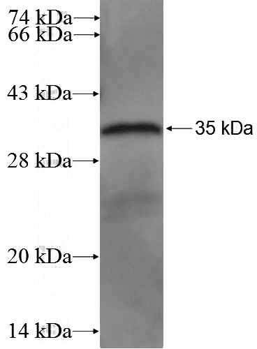 Recombinant Human REPIN1 SDS-PAGE