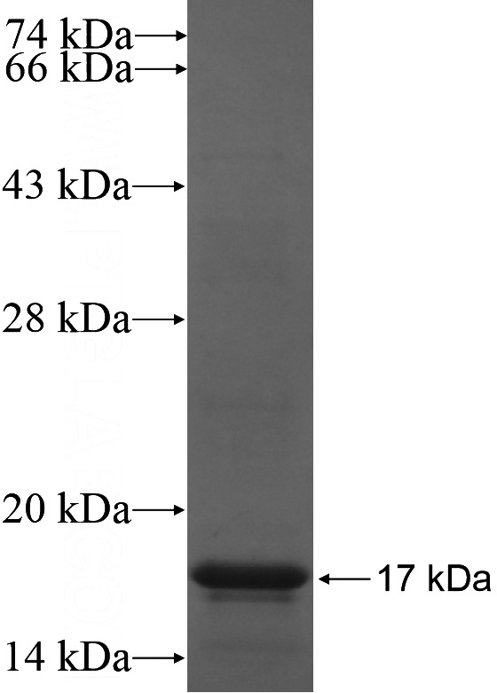 Recombinant Human ZDHHC15 SDS-PAGE