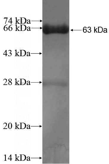 Recombinant Human KIAA2013 SDS-PAGE