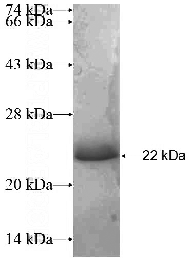 Recombinant Human SLC38A10 SDS-PAGE