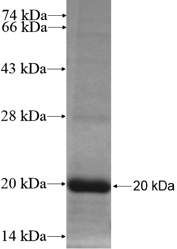 Recombinant Human MTTP SDS-PAGE