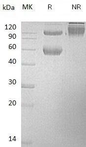 Mouse Bmpr1a/Acvrlk3/Bmpr (Fc & His tag) recombinant protein