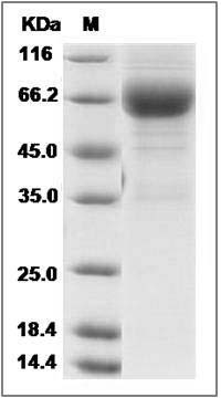 Rat LTBR / TNFRSF3 Protein (Fc Tag) SDS-PAGE