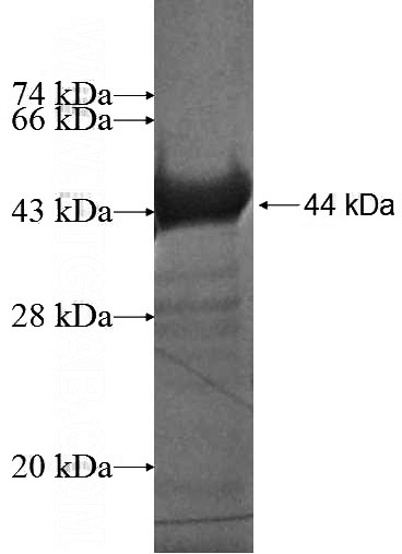 Recombinant Human APEH SDS-PAGE