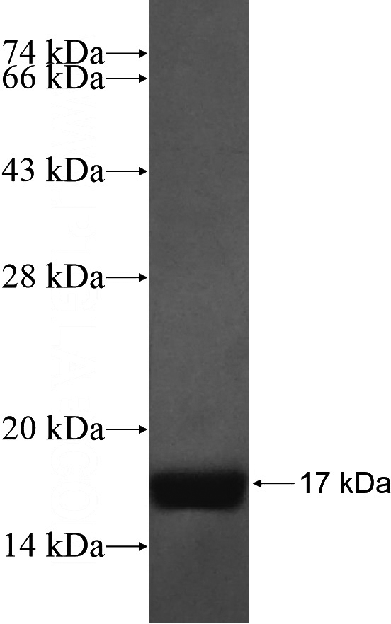 Recombinant Human THBS2 SDS-PAGE