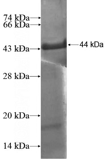 Recombinant Human OGDH SDS-PAGE