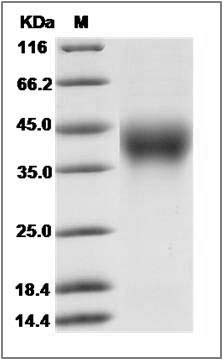 Cynomolgus LFA-3 / CD58 Protein (His Tag) SDS-PAGE