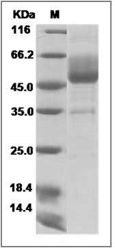 Human Mucin-1 / MUC-1 Protein (Fc Tag) SDS-PAGE