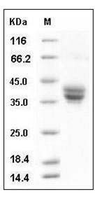 Mouse GPA33 / Glycoprotein A33 Protein (His Tag) SDS-PAGE