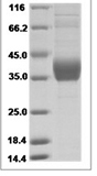 Human VEGFR2 / Flk-1 / CD309 / KDR Protein (Domain 2&3, His Tag)