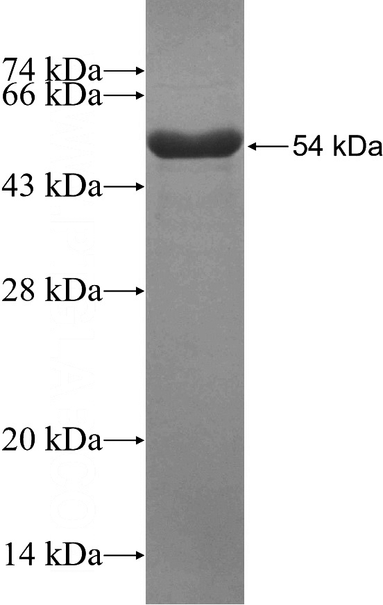 Recombinant Human MGA SDS-PAGE