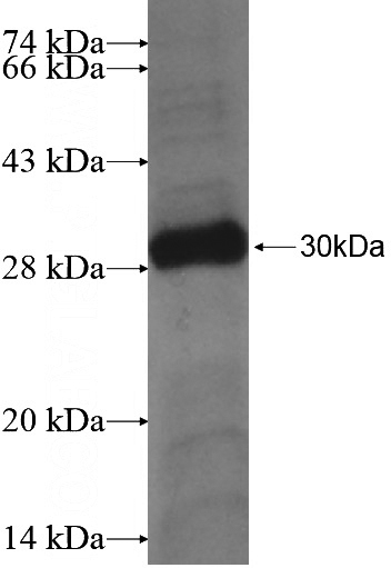 Recombinant Human STXBP6 SDS-PAGE