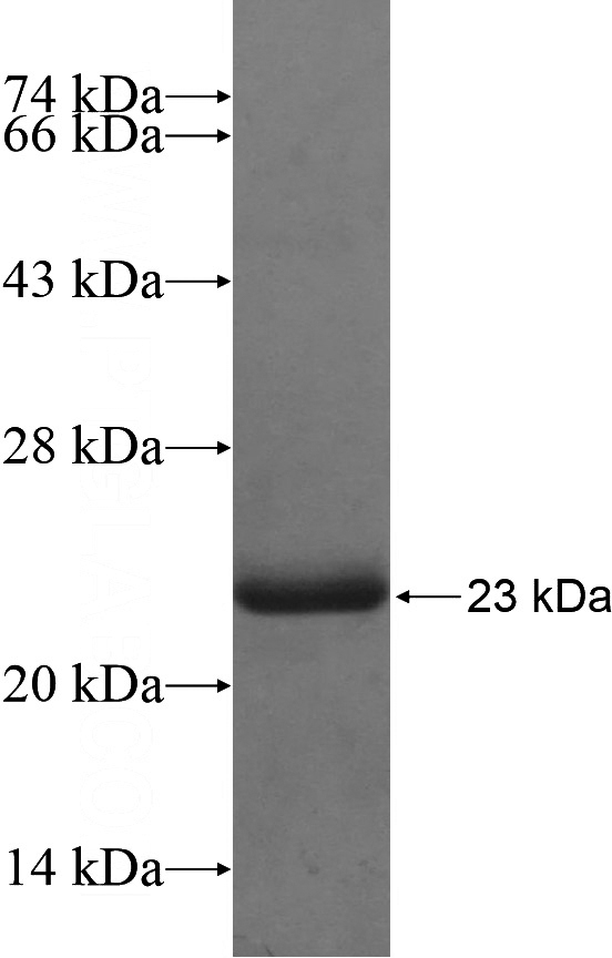 Recombinant Human CYP19A1 SDS-PAGE