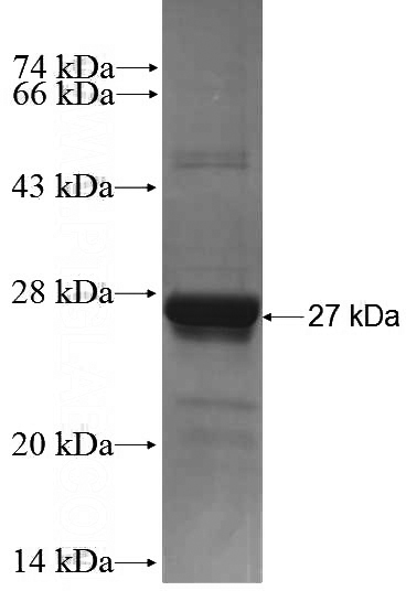 Recombinant Human RAB1A SDS-PAGE