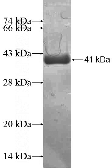 Recombinant Human UQCRC1 SDS-PAGE