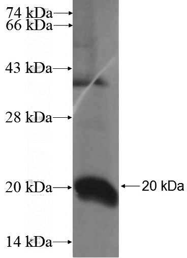Recombinant Human RPS16 SDS-PAGE