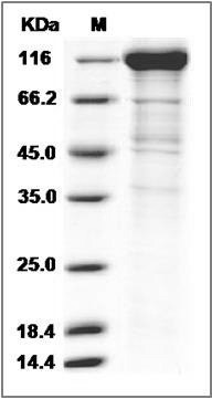 Cynomolgus IL6ST / gp130 Protein (Fc Tag) SDS-PAGE