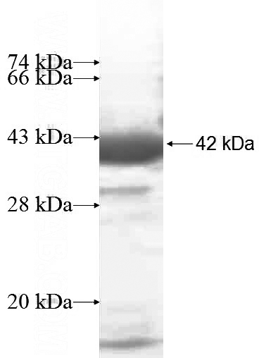 Recombinant Human RLBP1 SDS-PAGE