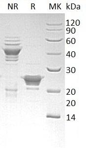 Human PRDX3/AOP1 recombinant protein