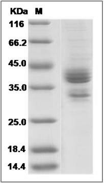 Human CGREF1 Protein (His Tag) SDS-PAGE