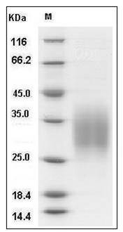 Mouse CD83 / HB15 Protein (His Tag) SDS-PAGE
