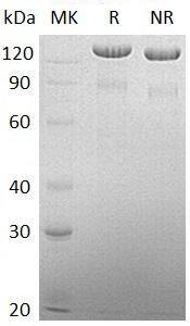 Human BCAN/BEHAB/CSPG7/UNQ2525/PRO6018 (His tag) recombinant protein