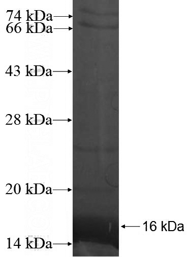 Recombinant Human ATAD4 SDS-PAGE