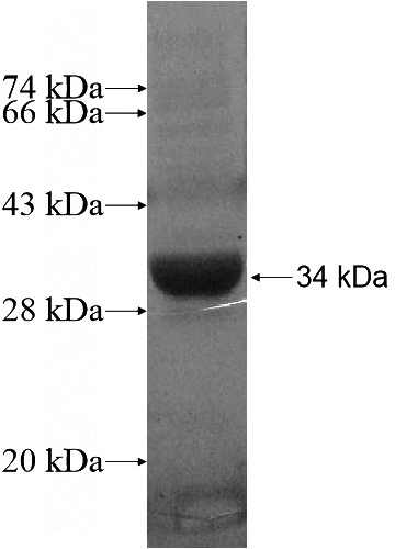 Recombinant Human SPRYD5 SDS-PAGE