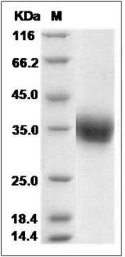 Cynomolgus Layilin / LAYN Protein (His Tag) SDS-PAGE