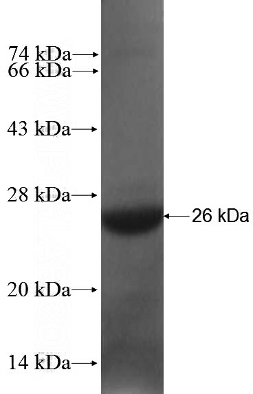 Recombinant Human BBS3 SDS-PAGE
