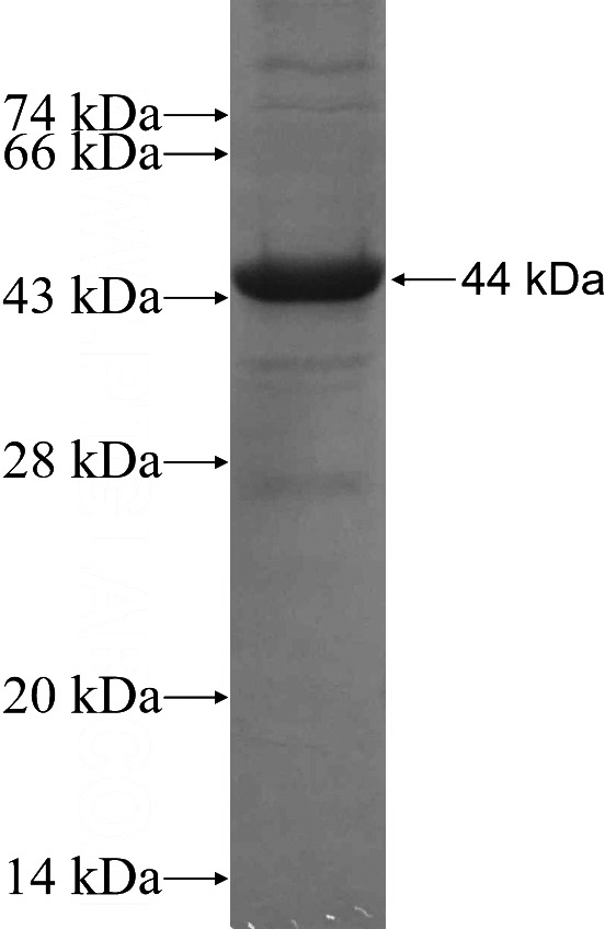 Recombinant Human RORC SDS-PAGE