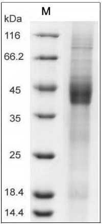 Human IGFBP3 / IBP3 Protein (His Tag) SDS-PAGE