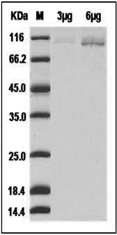 Human AGO2 / Argonaute 2 / EIF2C2 Protein (His Tag) SDS-PAGE