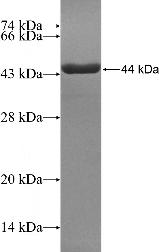 Recombinant Human RAD50 SDS-PAGE