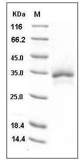 Human TFPI2 Protein (His Tag) SDS-PAGE