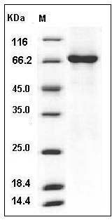 Human TAOK3 / JIK / MAP3K18 Protein (aa 1-411, His & GST Tag) SDS-PAGE