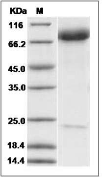 Mouse E-Selectin / CD62e / SELE Protein SDS-PAGE