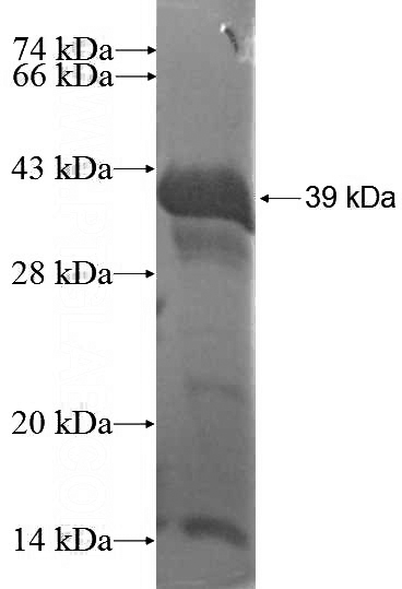 Recombinant Human GAK SDS-PAGE