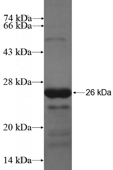 Recombinant Human DCHS1 SDS-PAGE