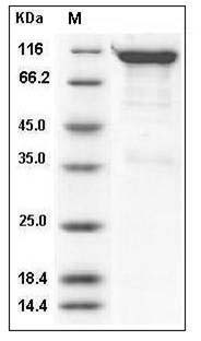 Human Semaphorin 4A / SEMA4A / Semaphorin B Protein (Fc Tag) SDS-PAGE