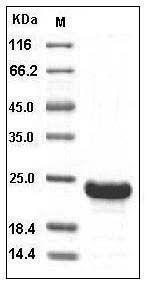 Human RBP4 Protein (His Tag) SDS-PAGE