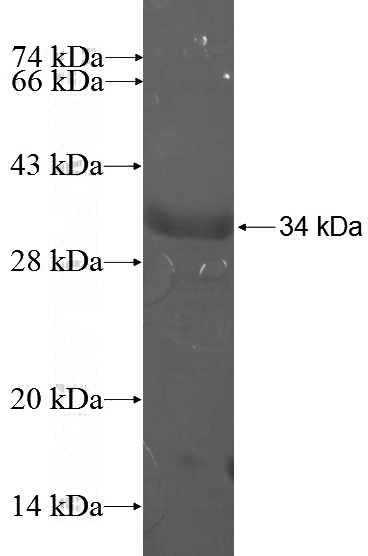 Recombinant Human SPAG16 SDS-PAGE
