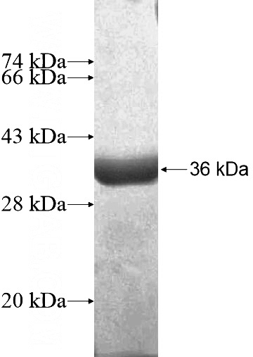 Recombinant Human PPCS SDS-PAGE