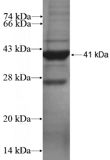 Recombinant Human KIAA2013 SDS-PAGE