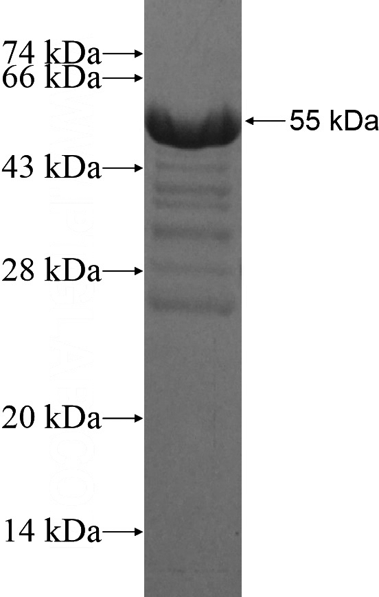 Recombinant Human PRDM16 SDS-PAGE